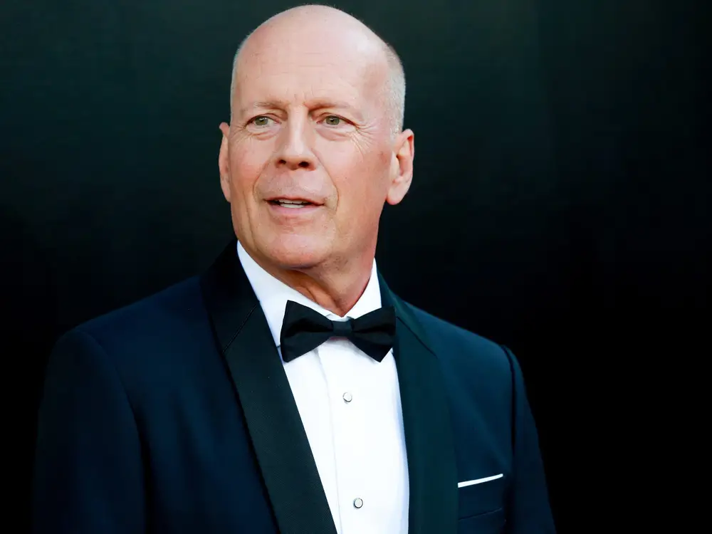 Bruce-Willis-has-been-diagnosed-with-Frontotemporal-dementia.