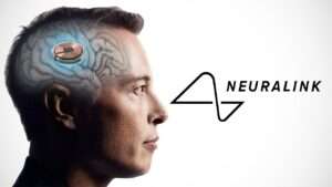 Neuralink