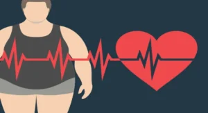 Obesity-in-America